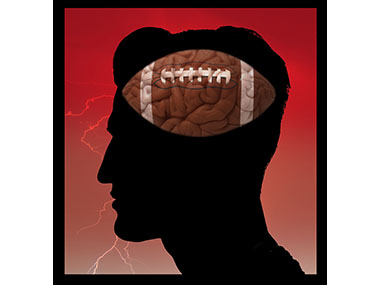 Bonus Football concussion sports injury NFL